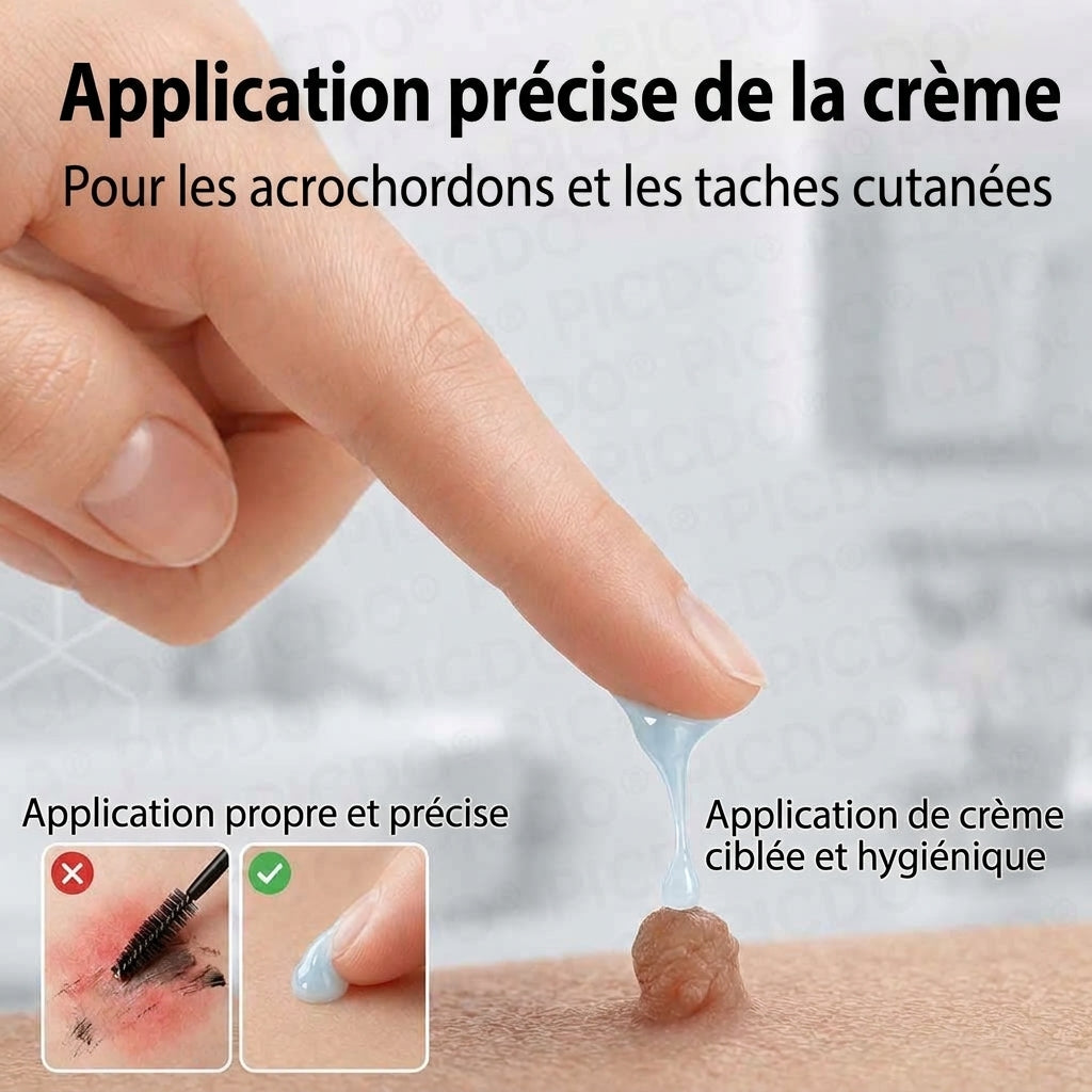 HISKIN® Crème Rénovatrice Ciblée 10-en-1 (Acrochordons & Taches) – Formule Botanique Sans Douleur ni Cicatrice, 7 Jours