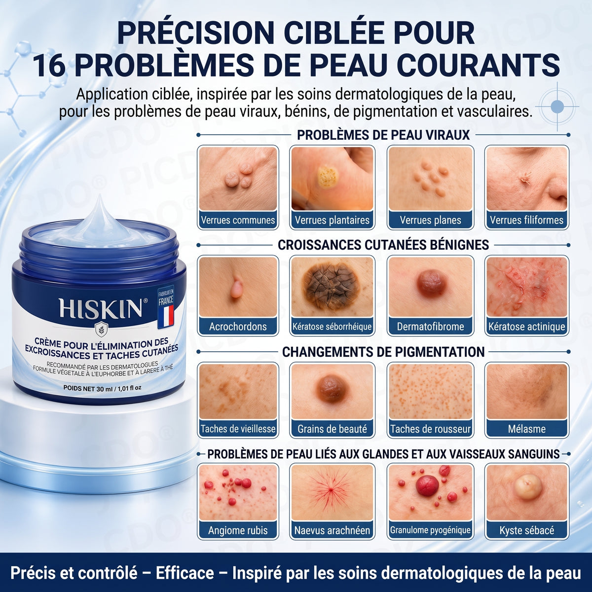HISKIN® Crème Rénovatrice Ciblée 10-en-1 (Acrochordons & Taches) – Formule Botanique Sans Douleur ni Cicatrice, 7 Jours