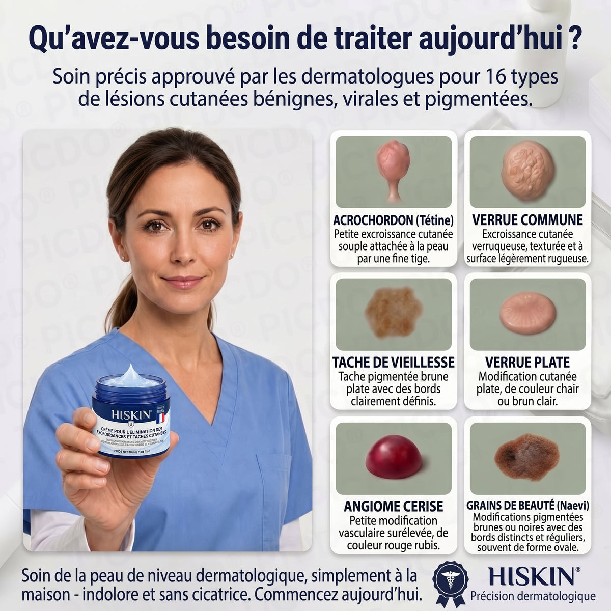 HISKIN® Crème Rénovatrice Ciblée 10-en-1 (Acrochordons & Taches) – Formule Botanique Sans Douleur ni Cicatrice, 7 Jours